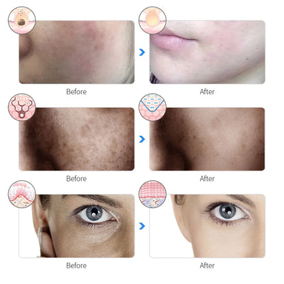RECHARGABLE FACIAL BEAUTY LED MASK